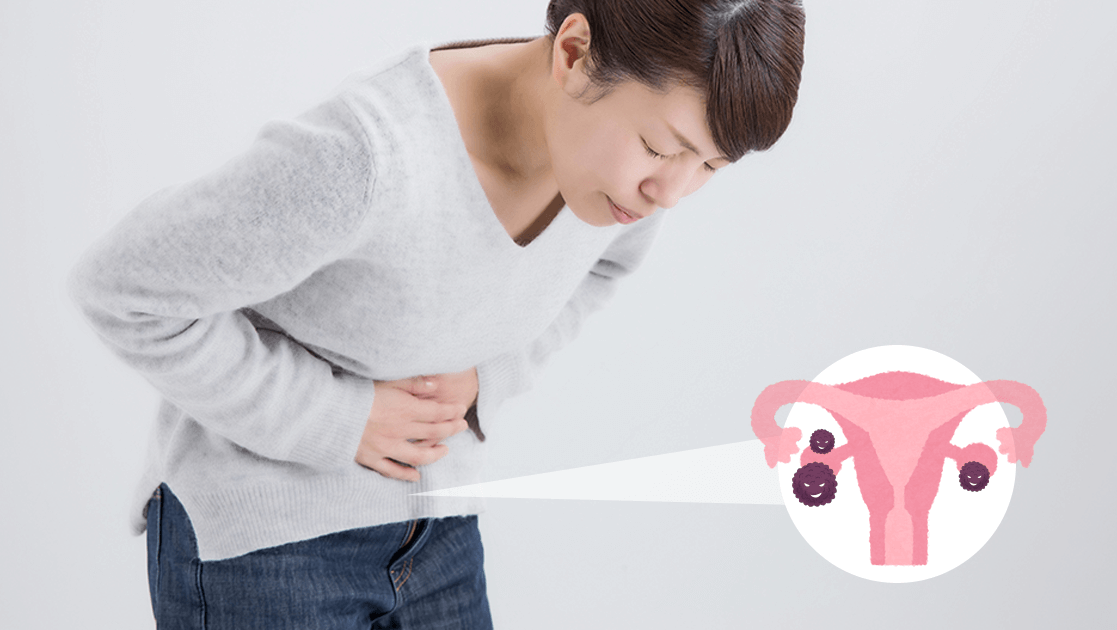 难发现的「卵巢癌」症状,分期一次看懂