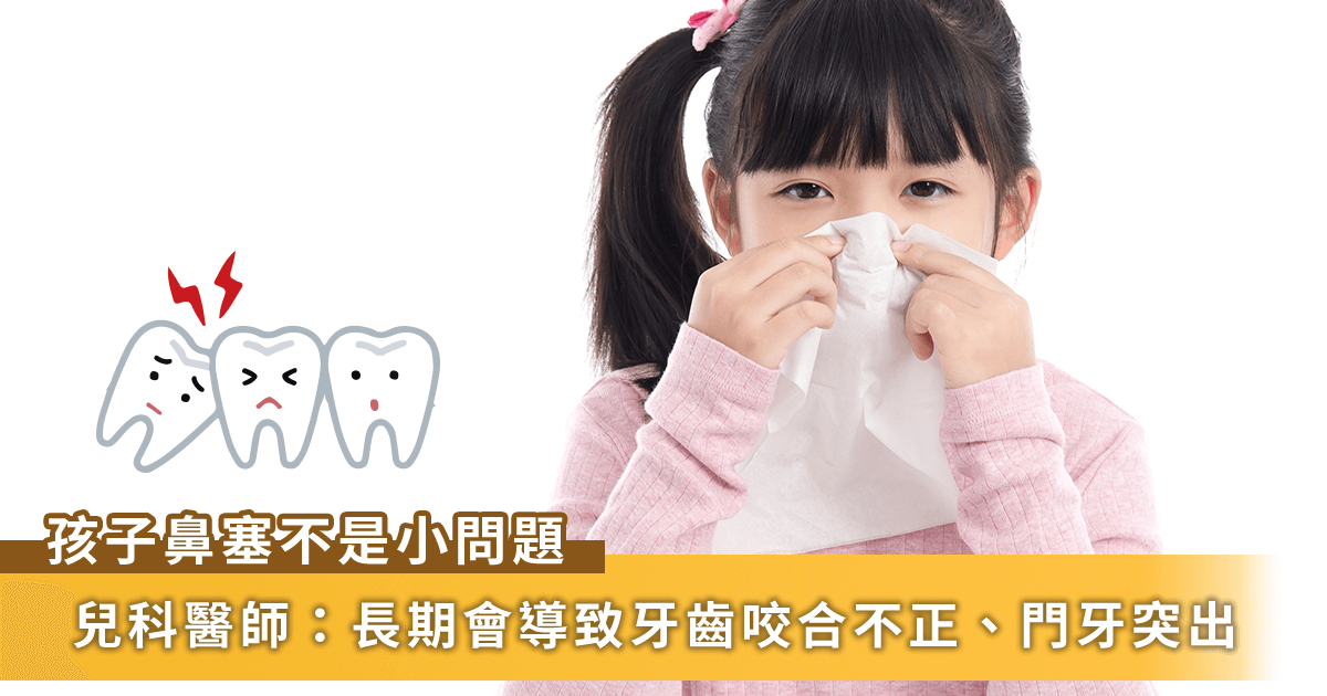 孩子過敏「鼻塞」不是小問題！兒科醫師：嚴重影響兒童牙齒咬合及暴牙
