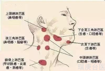 为什么淋巴癌多为年轻患者？