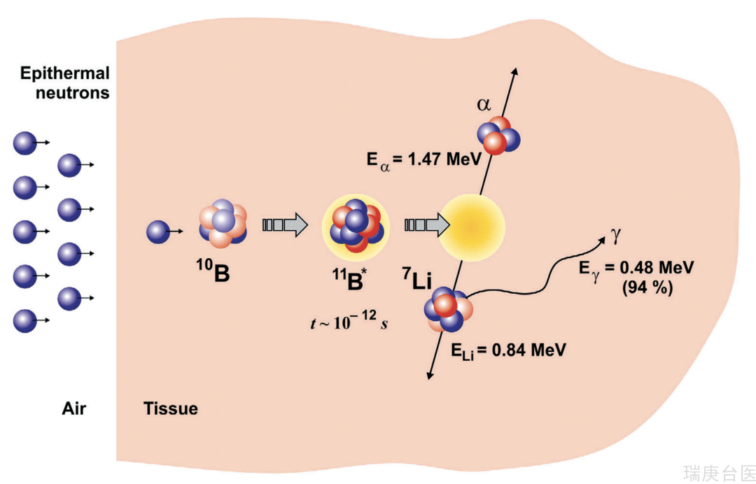 BNCT案例 | 硼中子俘获疗法治疗厉害吗？