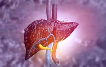 質子治療 | 肝癌患者治療2月腫瘤縮小明顯