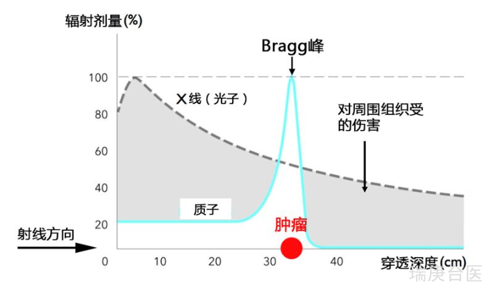 质子治疗 | 长在眼睛、脑子、脊柱等重要器官，无法手术容易复发肿瘤的新选择