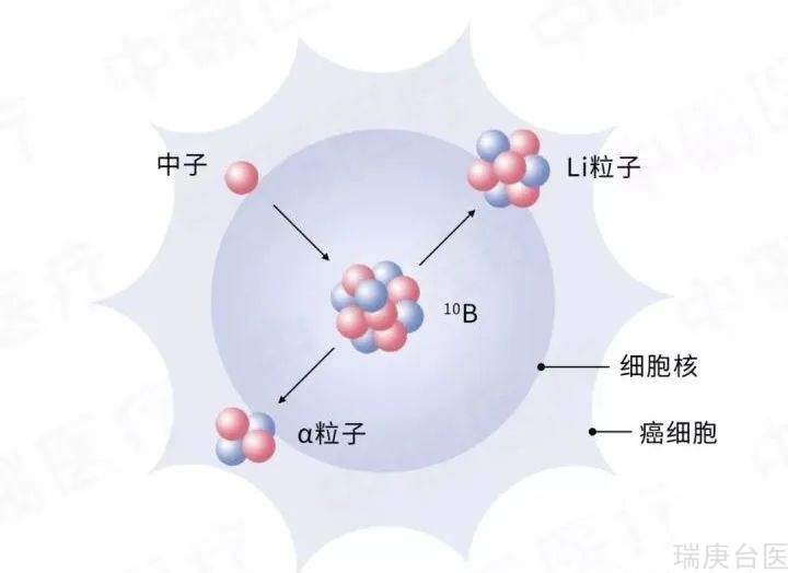 临床研究 | BNCT对肝转移癌具有良好的治疗