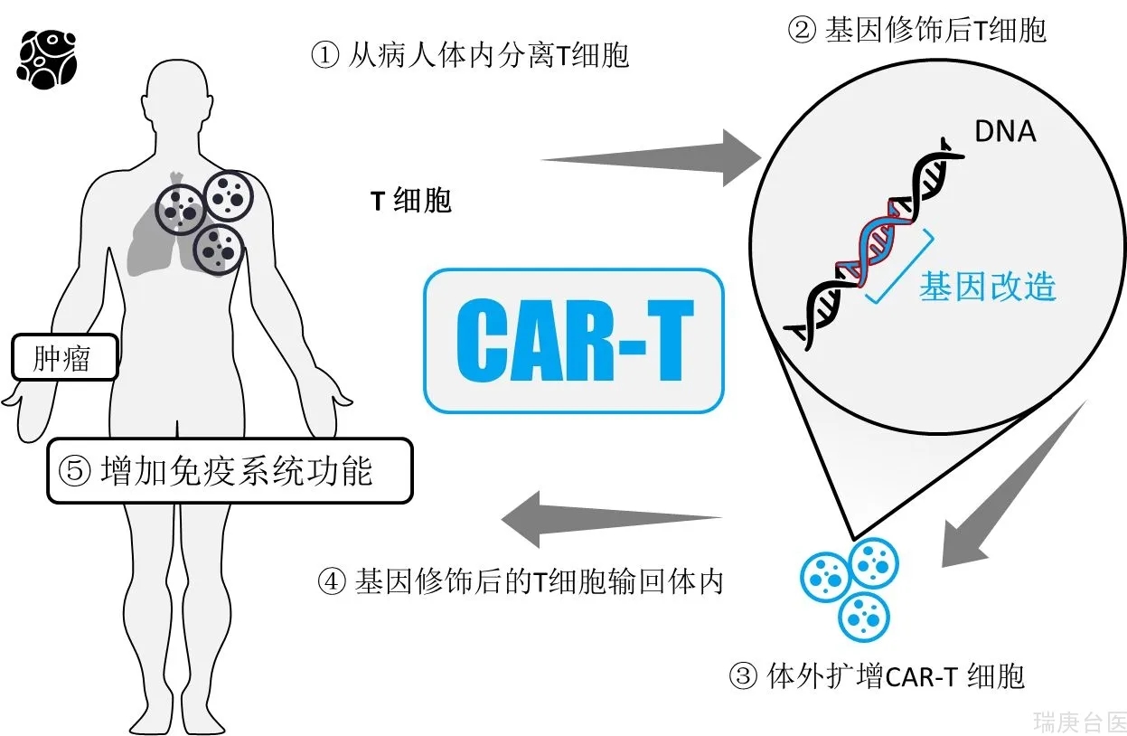 BNCT&CAR-T | 硼中子療法VS免疫療法