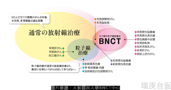 硼中子俘獲療法 | BNCT治療放射性骨肉瘤